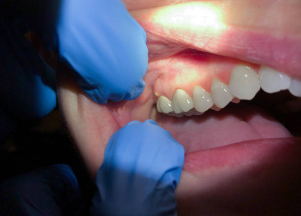 Best Emergency Dental Services for Seniors in Crouch Mesa, NM